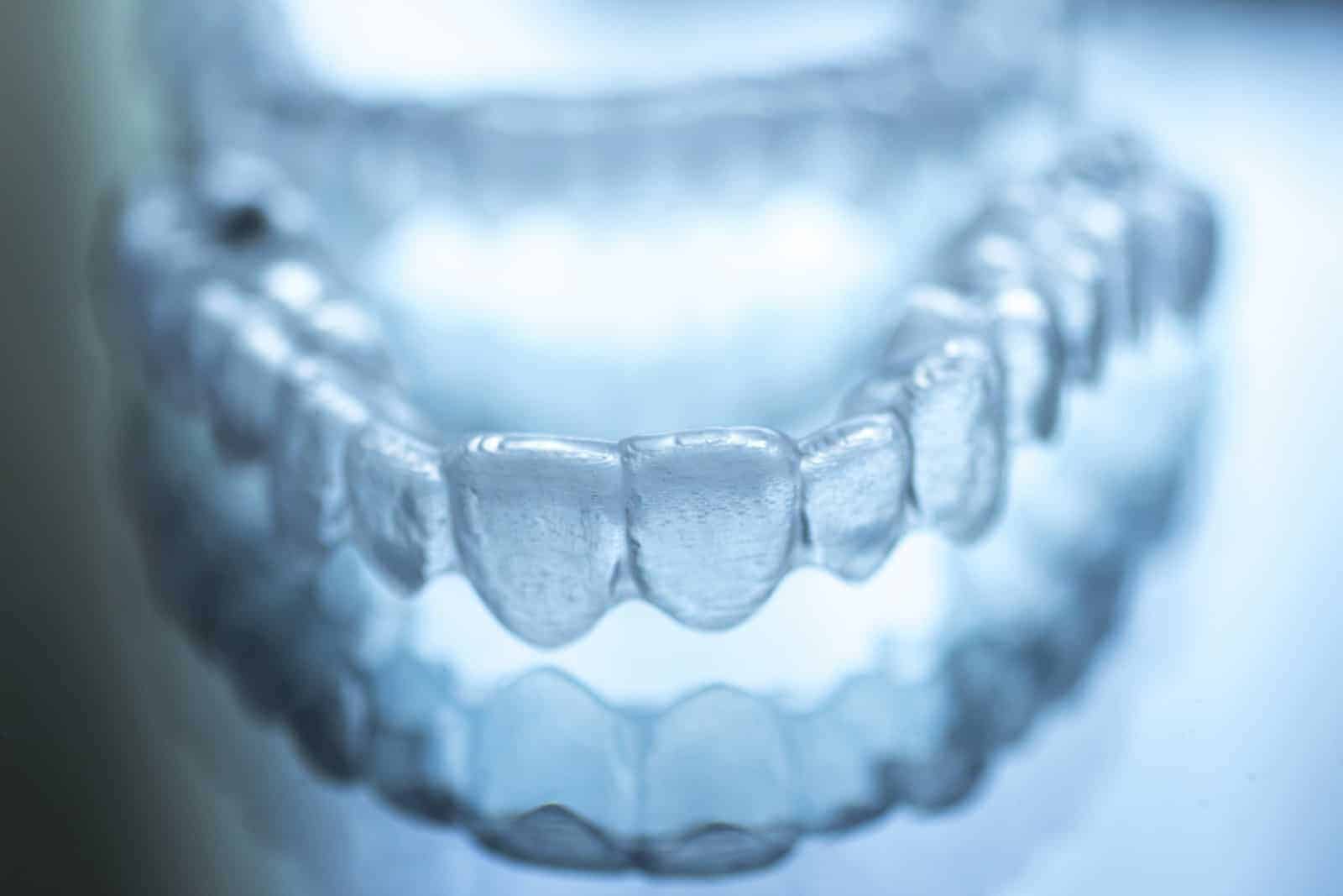 Invisalign invisible braces clear aligners